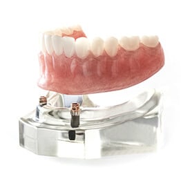 Dental implants and permanent false teeth · Implantation Dental Center