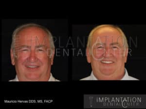 Plantation, Florida Dental Implant Specialist Dr. Mauricio Hervas