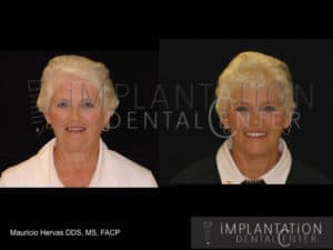 Plantation, Florida Dental Implant Specialist Dr. Mauricio Hervas