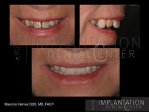 Plantation, Florida Dental Implant Specialist Dr. Mauricio Hervas