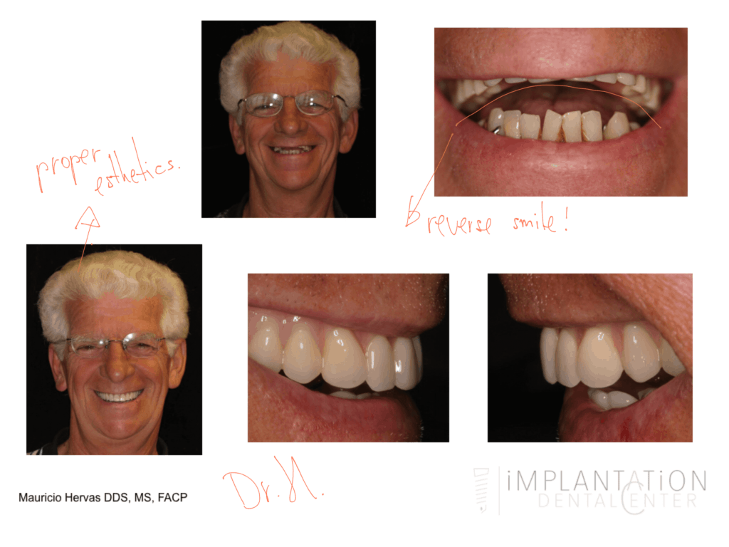 Plantation, Florida Dental Implant Specialist Dr. Mauricio Hervas