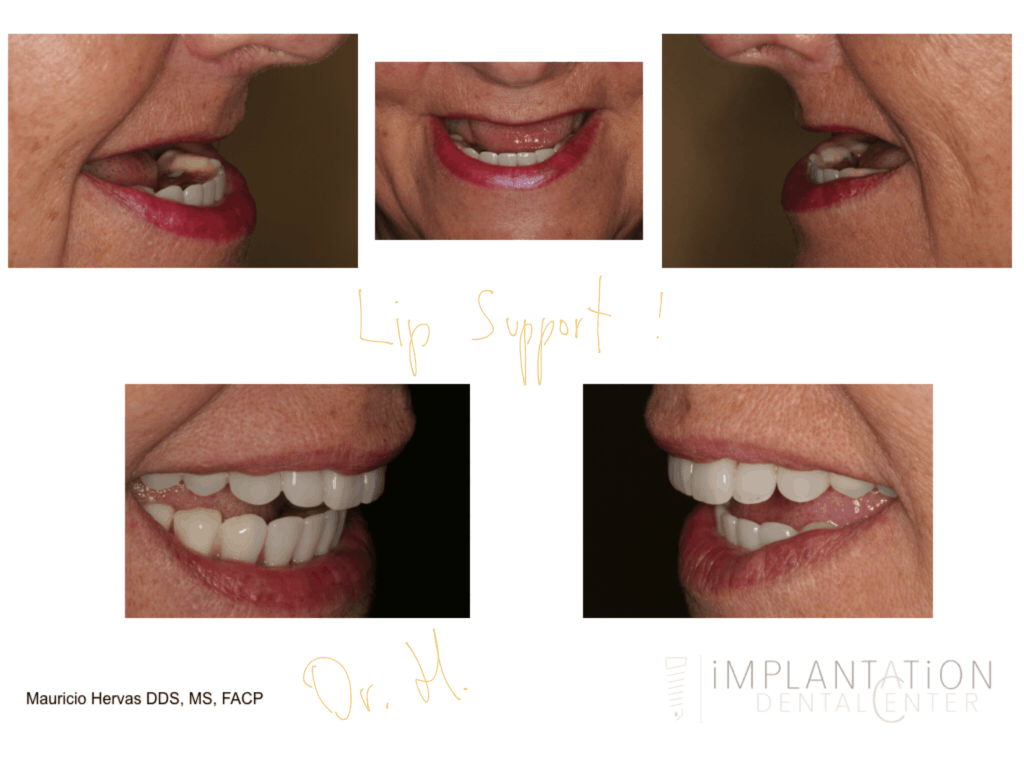 Plantation, Florida Dental Implant Specialist Dr. Mauricio Hervas