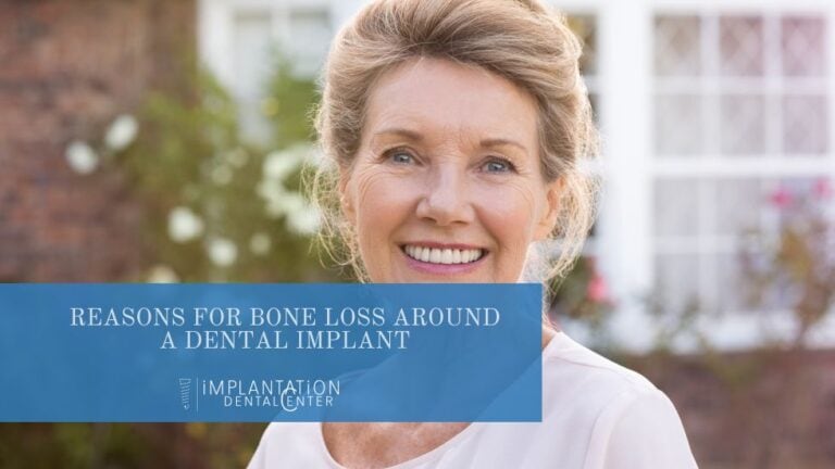 Reasons for Bone Loss Around a Dental Implant