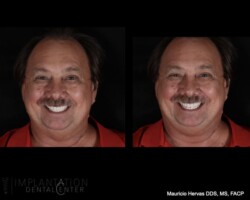 Before and after. Pleasant smile