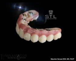 PMMA prototype. All on X