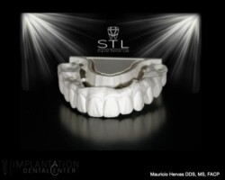 Zirconia in progress. Pre sintering