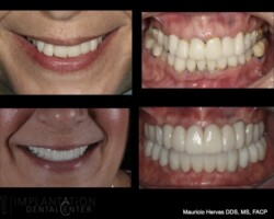Before and after. All on X